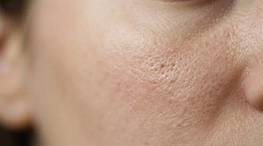Close-up of clear skin texture with subtle pore details showing the contrast between healthy and congested pores in natural light